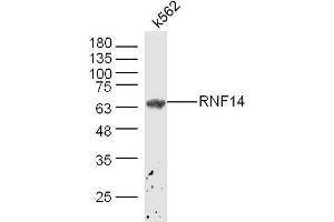 K562 lysates probed with ADAM2 Polyclonal Antibody, Unconjugated  at 1:300 dilution and 4˚C overnight incubation.