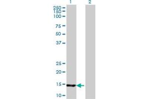 Western Blot analysis of UBE2B expression in transfected 293T cell line by UBE2B monoclonal antibody (M06), clone 4C3. (UBE2B 抗体  (AA 63-152))