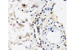 Immunohistochemistry of paraffin-embedded Human lung using CAND1 Polyclonal Antibody at dilution of 1:100 (40x lens). (CAND1 抗体)