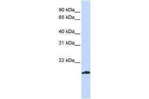 WB Suggested Anti-PLDN Antibody Titration: 0. (Pallidin 抗体  (Middle Region))