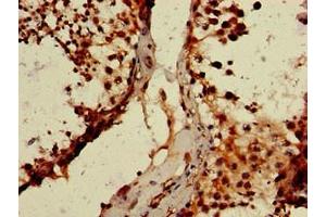 Immunohistochemistry of paraffin-embedded human testis tissue using ABIN7164194 at dilution of 1:100 (WTAP 抗体  (AA 1-151))