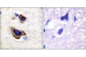 Immunohistochemistry analysis of paraffin-embedded human brain tissue, using GFAP (Ab-38) Antibody. (GFAP 抗体  (AA 11-60))