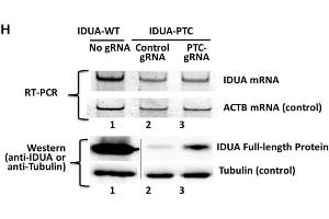 Western Blotting Analysis Source: PMID36764303 (IDUA 抗体)