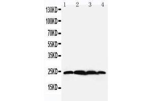 Anti-BAG2 antibody, Western blotting Lane 1: Rat Testis Tissue Lysate Lane 2: HELA Cell Lysate Lane 3: A549 Cell Lysate Lane 4: A431 Cell Lysate (BAG2 抗体  (N-Term))