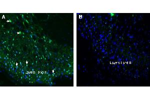 Expression of Tetraspanin 2 (TSPAN2) in rat spinal cord. (Tetraspanin 2 抗体  (Extracellular))