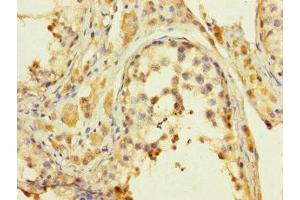 Immunohistochemistry of paraffin-embedded human testis tissue using ABIN7157150 at dilution of 1:100 (JMJD5 抗体  (AA 151-380))