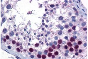 Human Testis: Formalin-Fixed, Paraffin-Embedded (FFPE) (SIRT6 抗体  (AA 56-105))