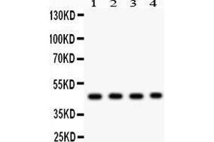 Anti- MBD2 antibody, Western blotting All lanes: Anti MBD2  at 0. (MBD2 抗体  (AA 159-411))