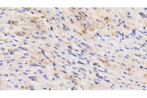 Detection of ALB in Human Cardiac Muscle Tissue using Polyclonal Antibody to Albumin (ALB) (Albumin 抗体)