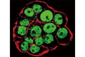 Confocal immunofluorescent analysis of phospho CDX2 antibody and WiDr cells followed by Alexa Fluor 488-conjugated goat anti-rabbit lgG (green).