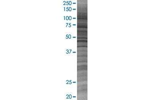 EMP3 transfected lysate.