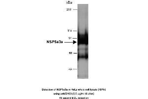 anti-Sperm Antigen with Calponin Homology and Coiled-Coil Domains 1 (SPECC1) (AA 200-300) antibody