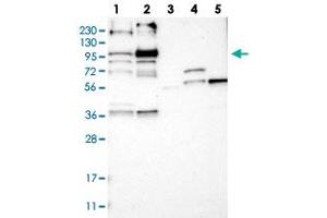 Western blot analysis of Lane 1: RT-4, Lane 2: U-251 MG, Lane 3: Human Plasma, Lane 4: Liver, Lane 5: Tonsil with LRCH2 polyclonal antibody  at 1:250-1:500 dilution. (LRCH2 抗体)