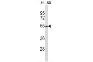 MGAT3 Antibody (C-term) western blot analysis in HL-60 cell line lysates (35µg/lane). (MGAT3 抗体  (C-Term))