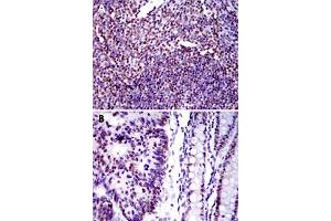 Immunohistochemical analysis of paraffin-embedded human tonsil tissue (A) and human colon cancer tissue (B) using XRCC5 monoclonal antobody, clone 5C5  with DAB staining. (XRCC5 抗体)
