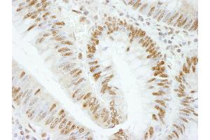 Immunohistochemistry (IHC) image for anti-RNA Binding Motif Protein 25 (RBM25) (AA 475-525) antibody (ABIN7448762)