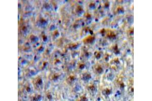 IHC-P analysis of Liver tissue, with DAB staining. (TCF20 抗体  (AA 125-213))