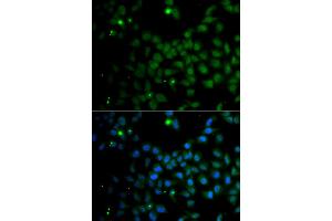 Immunofluorescence analysis of A549 cells using SMAD9 antibody. (SMAD9 抗体)