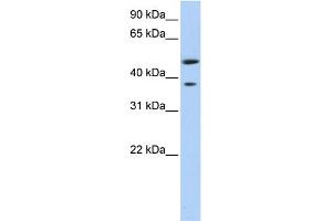 WB Suggested Anti-MAGEA3 Antibody Titration:  0. (MAGEA3 抗体  (Middle Region))