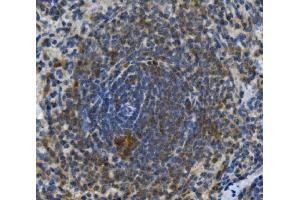 IHC analysis of TLR1 using anti-TLR1 antibody (ABIN7602194).