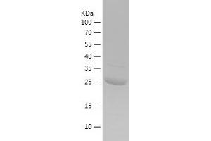 Western Blotting (WB) image for Chorionic Somatomammotropin Hormone 1 (Placental Lactogen) (CSH1) (AA 27-217) protein (His tag) (ABIN7283181) (CSH1 Protein (AA 27-217) (His tag))