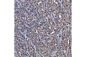 IHC analysis of SAE1 using anti-SAE1 antibody (ABIN7601346).