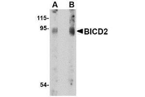 Image no. 1 for anti-Bicaudal D Homolog 2 (BICD2) (C-Term) antibody (ABIN342679) (BICD2 抗体  (C-Term))