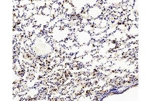 Immunohistochemistry analysis of paraffin-embedded mouse Inflammatory lung using Ly6g Polyclonal Antibody at dilution of 1:200. (Ly6g 抗体)