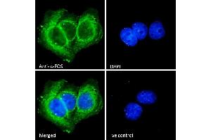 (ABIN5539622) Immunofluorescence analysis of paraformaldehyde fixed MCF7 cells, permeabilized with 0.