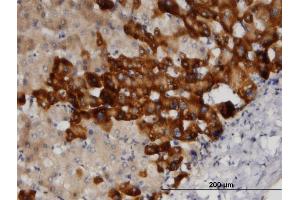 Immunostaining (ISt) image for anti-Proto-oncogene tyrosine-protein kinase Src (Src) (AA 1-90) antibody (ABIN520463)