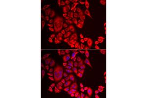 Immunofluorescence analysis of MCF-7 cells using QPCT antibody (ABIN5974054). (QPCT 抗体)