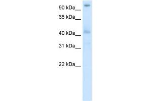 WB Suggested Anti-POGZ Antibody Titration:  5. (POGZ 抗体  (N-Term))