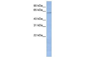 WB Suggested Anti-CYP2C19 Antibody Titration:  0. (CYP2C19 抗体  (Middle Region))