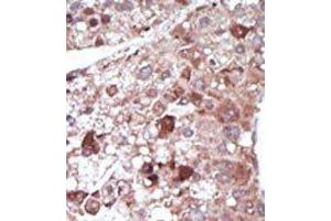 Image no. 2 for anti-phosphoenolpyruvate Carboxykinase 1 (Soluble) (PCK1) (N-Term) antibody (ABIN360565) (PCK1 抗体  (N-Term))