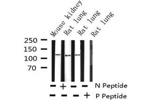 Western blot analysis of Phospho-FAK (Tyr397) expression in various lysates