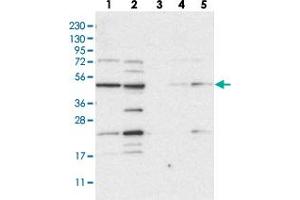 Western blot analysis of Lane 1: RT-4, Lane 2: U-251 MG, Lane 3: Human Plasma, Lane 4: Liver, Lane 5: Tonsil with NAPEPLD polyclonal antibody  at 1:250-1:500 dilution. (NAPEPLD 抗体)