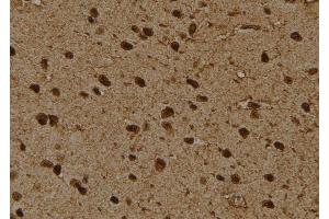 Immunohistochemistry (IHC) image for anti-Proteasome (Prosome, Macropain) 26S Subunit, Non-ATPase, 4 (Psmd4) (Internal Region) antibody (ABIN6264490)