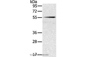 Western blot analysis of Mouse pancreas tissue, using SLC16A10 Polyclonal Antibody at dilution of 1:200 (SLC16A10 抗体)