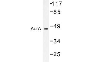 Image no. 1 for anti-Aurora Kinase A (AURKA) antibody (ABIN272125) (Aurora A 抗体)