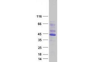 Western Blotting (WB) image for PDZ and LIM Domain 2 (PDLIM2) (Transcript Variant 1) protein (Myc-DYKDDDDK Tag) (ABIN2728590)