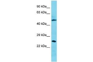 Host: Rabbit Target Name: C3orf26 Sample Type: 721_B Whole Cell lysates Antibody Dilution: 1. (CMSS1 抗体  (N-Term))
