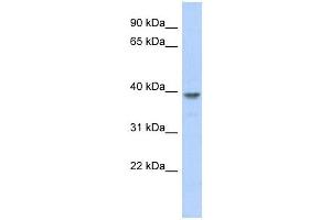 MED8 antibody used at 1 ug/ml to detect target protein. (MED8 抗体  (N-Term))