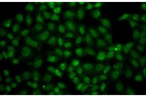 Immunofluorescence analysis of A549 cells using USP26 Polyclonal Antibody (USP26 抗体)
