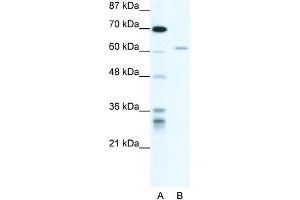 Human HepG2; WB Suggested Anti-ZNFN1A4 Antibody Titration: 1. (IKZF4 抗体  (N-Term))