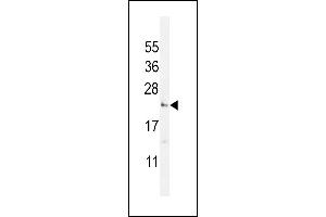UTS2 Antibody (N-term) (ABIN392523 and ABIN2842080) western blot analysis in WiDr cell line lysates (35 μg/lane). (Urotensin 2 抗体  (N-Term))