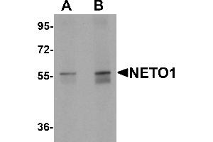 Western blot analysis of NETO1 in human lung tissue lysate with NETO1 antibody at (A) 1 and (B) 2 µg/mL. (NETO1 抗体  (C-Term))