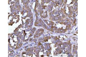 IHC analysis of ERP29 using anti-ERP29 antibody (ABIN7601342). (ERP29 抗体  (AA 33-196))