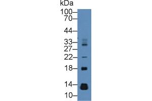 Detection of MEC in Mouse Pancreas lysate using Polyclonal Antibody to Mucosae Associated Epithelia Chemokine (MEC) (Mucosae Associated Epithelia Chemokine (AA 29-131) 抗体)