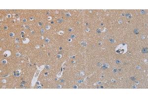 Immunohistochemistry of paraffin-embedded Human brain tissue using HSD3B7 Polyclonal Antibody at dilution 1:40 (HSD3B7 抗体)