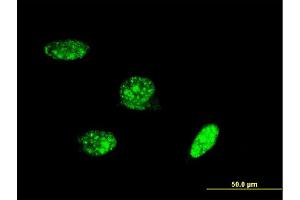 Immunofluorescence of monoclonal antibody to PAX8 on HeLa cell. (PAX8 抗体  (AA 1-450))